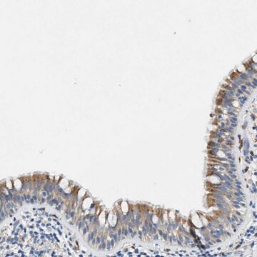 Anti-ZDHHC13 antibody produced in rabbit Prestige Antibodies&#174; Powered by Atlas Antibodies, affinity isolated antibody, buffered aqueous glycerol solution