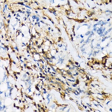 Anti-PSMB9/LMP2 antibody produced in rabbit