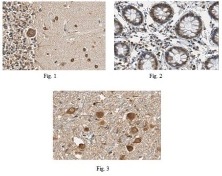 Anti-SYPL1 Antibody from rabbit, purified by affinity chromatography