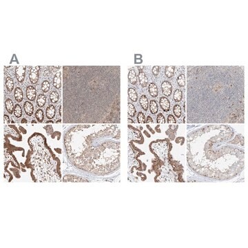 Anti-BYSL antibody produced in rabbit Prestige Antibodies&#174; Powered by Atlas Antibodies, affinity isolated antibody, buffered aqueous glycerol solution, ab2