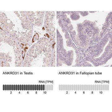 Anti-ANKRD31 antibody produced in rabbit Prestige Antibodies&#174; Powered by Atlas Antibodies, affinity isolated antibody, buffered aqueous glycerol solution