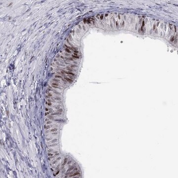 Anti-Dbf4B Antibody Produced In Rabbit Prestige Antibodies&#174; Powered by Atlas Antibodies, affinity isolated antibody, buffered aqueous glycerol solution