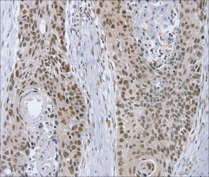 Anti-RNF20 affinity isolated antibody