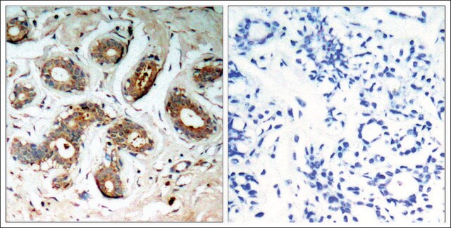 Anti-phospho-YWHAZ (pSer58) antibody produced in rabbit affinity isolated antibody