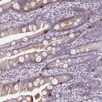 Anti-ABHD16B antibody produced in rabbit Prestige Antibodies&#174; Powered by Atlas Antibodies, affinity isolated antibody, buffered aqueous glycerol solution