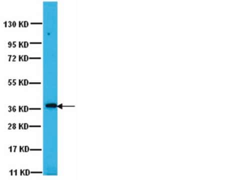 Przeciwciało anty-PP1γ1 Upstate&#174;, from rabbit