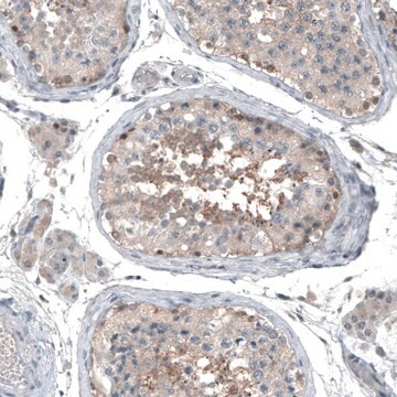 Anti-ABCC11 antibody produced in rabbit Prestige Antibodies&#174; Powered by Atlas Antibodies, affinity isolated antibody, buffered aqueous glycerol solution