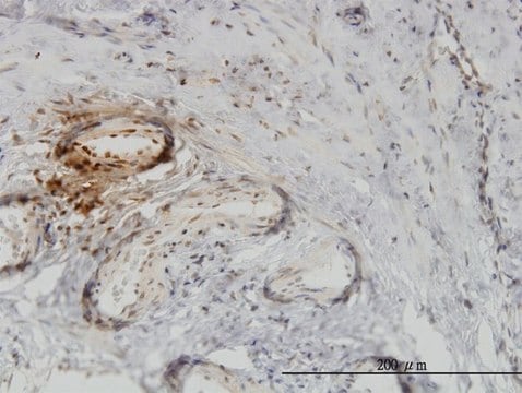 Monoclonal Anti-PTK9, (C-terminal) antibody produced in mouse clone 1E2, purified immunoglobulin, buffered aqueous solution