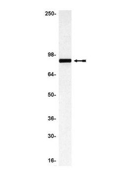 Anti-Ezrin Antibody Upstate&#174;, from rabbit