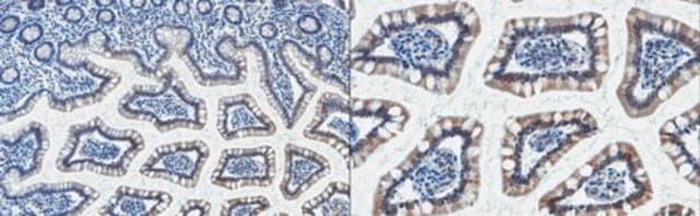 Anti-UGT1A10 Antibody, clone 20H1 clone 20H1, from mouse