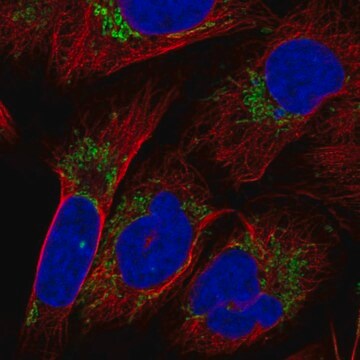 Anti-Klhl29 Antibody Produced In Rabbit Prestige Antibodies&#174; Powered by Atlas Antibodies, affinity isolated antibody, buffered aqueous glycerol solution