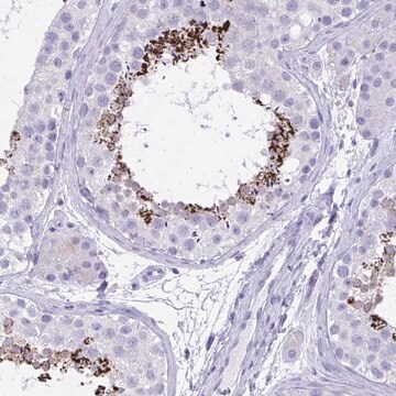 Anti-MON1A antibody produced in rabbit Prestige Antibodies&#174; Powered by Atlas Antibodies, affinity isolated antibody, buffered aqueous glycerol solution