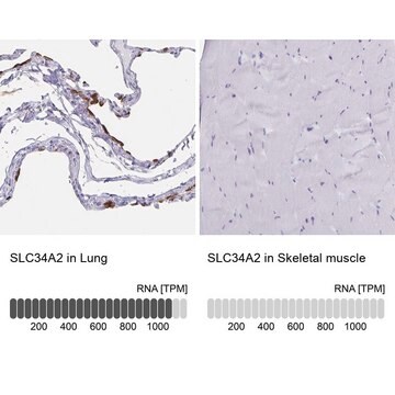 Anti-SLC34A2 antibody produced in rabbit Prestige Antibodies&#174; Powered by Atlas Antibodies, affinity isolated antibody, buffered aqueous glycerol solution