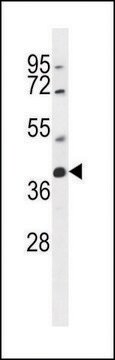 ANTI-SRD5A2L2 (C-TERM) antibody produced in rabbit IgG fraction of antiserum, buffered aqueous solution