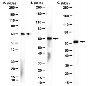 Anti-CNOT6 Antibody, clone Y6206