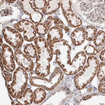 Anti-ZFYVE16 antibody produced in rabbit Prestige Antibodies&#174; Powered by Atlas Antibodies, affinity isolated antibody, buffered aqueous glycerol solution