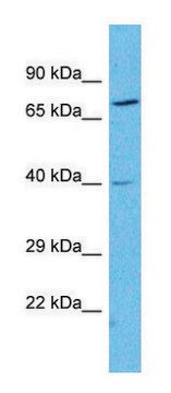 Anti-NPY2R (N-terminal) antibody produced in rabbit affinity isolated antibody