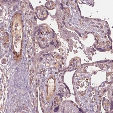 Anti-PDGFD antibody produced in rabbit Prestige Antibodies&#174; Powered by Atlas Antibodies, affinity isolated antibody, buffered aqueous glycerol solution