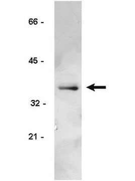 Anticorps anti-cycline&nbsp;D1/2, clone&nbsp;5D4 clone 5D4, Upstate&#174;, from mouse