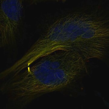 Anti-Cenpe Antibody Produced In Rabbit Prestige Antibodies&#174; Powered by Atlas Antibodies, affinity isolated antibody, buffered aqueous glycerol solution