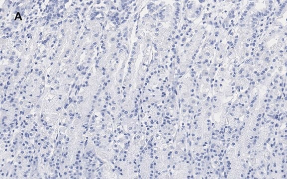 Anti-IKB &#945; Antibody, clone 6O8, ZooMAb&#174; Rabbit Monoclonal recombinant, expressed in HEK 293 cells