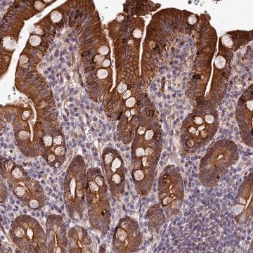 Anti-ABCB8 antibody produced in rabbit Prestige Antibodies&#174; Powered by Atlas Antibodies, affinity isolated antibody, buffered aqueous glycerol solution