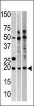 Anti-DHX15 (C-term) antibody produced in rabbit IgG fraction of antiserum, buffered aqueous solution