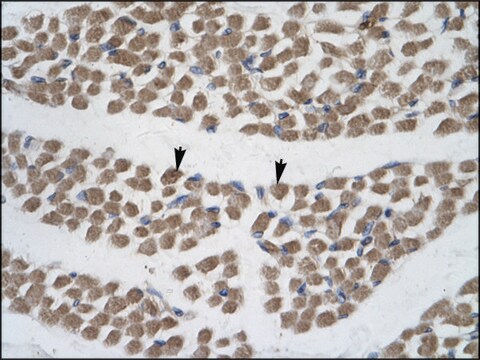 Anti-BRCA1 antibody produced in rabbit affinity isolated antibody