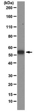 Anti-G3BP1 Antibody, clone 14E5-G9 clone 14E5-G9, from mouse