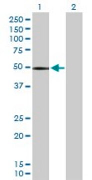 Anti-CHIT1 antibody produced in rabbit purified immunoglobulin, buffered aqueous solution