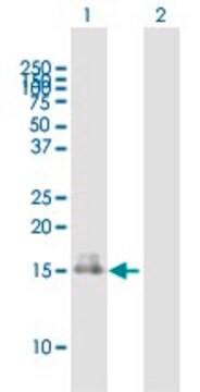 Anti-RARRES2 antibody produced in mouse purified immunoglobulin, buffered aqueous solution