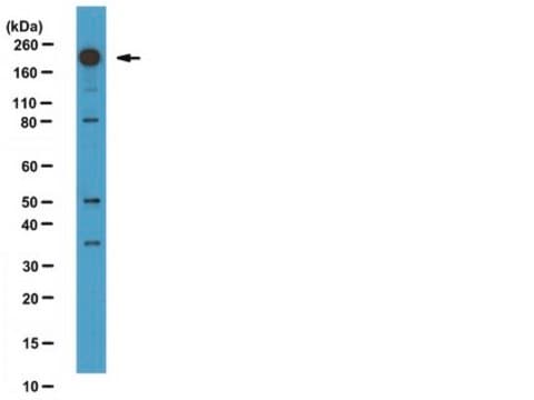 Anti-Phospho-Dnmt1(Ser714) Antibody from rabbit