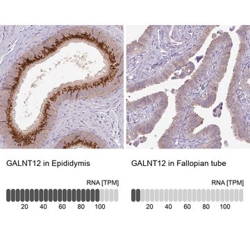 Anti-GALNT12 antibody produced in rabbit Prestige Antibodies&#174; Powered by Atlas Antibodies, affinity isolated antibody, buffered aqueous glycerol solution