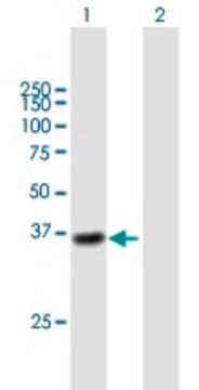 Anti-CTSL1 antibody produced in mouse purified immunoglobulin, buffered aqueous solution