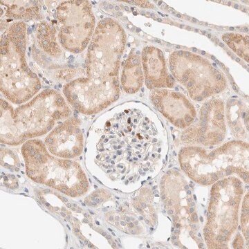 Anti-TTC3 antibody produced in rabbit Prestige Antibodies&#174; Powered by Atlas Antibodies, affinity isolated antibody, buffered aqueous glycerol solution, Ab2