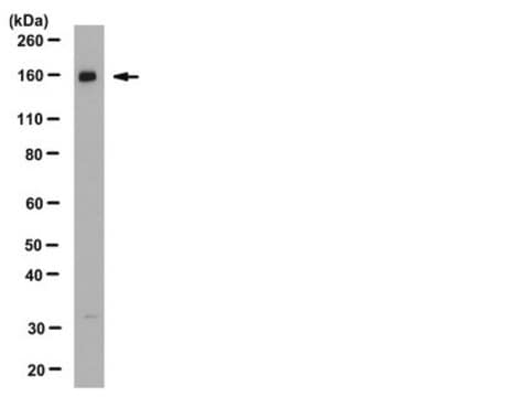 Anti-Na+K+Cl- Cotransporter 2 Antibody from rabbit, purified by affinity chromatography