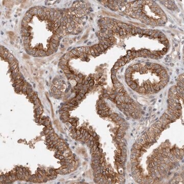 Anti-CRISPLD1 antibody produced in rabbit Prestige Antibodies&#174; Powered by Atlas Antibodies, affinity isolated antibody, buffered aqueous glycerol solution