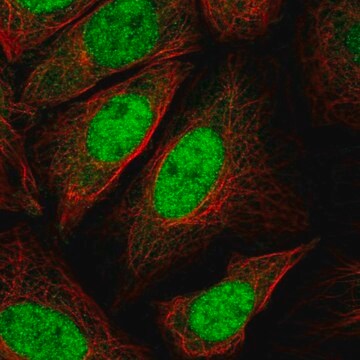 Anti-CDKN1B antibody produced in rabbit Prestige Antibodies&#174; Powered by Atlas Antibodies, affinity isolated antibody