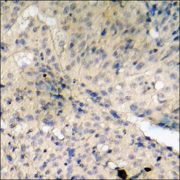 Anti-phospho-Desmin (pSer60) antibody produced in rabbit affinity isolated antibody