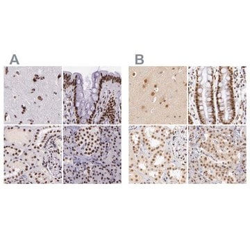 Anti-GPKOW antibody produced in rabbit Ab2, Prestige Antibodies&#174; Powered by Atlas Antibodies, affinity isolated antibody, buffered aqueous glycerol solution