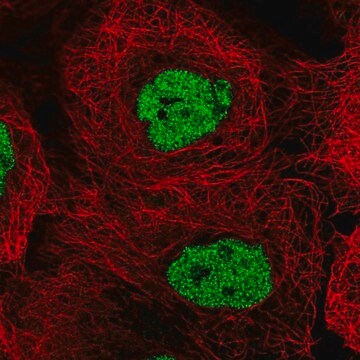 Anti-CSNK2A1 antibody produced in rabbit Prestige Antibodies&#174; Powered by Atlas Antibodies, affinity isolated antibody