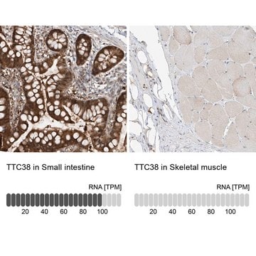 Anti-TTC38 antibody produced in rabbit Prestige Antibodies&#174; Powered by Atlas Antibodies, affinity isolated antibody, buffered aqueous glycerol solution