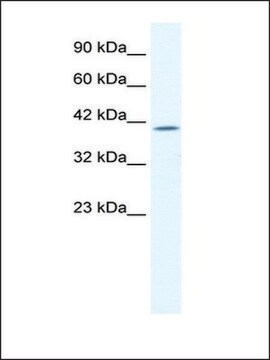 Anti-ELK4 antibody produced in rabbit IgG fraction of antiserum