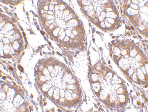 Anti-PTK7 antibody produced in rabbit affinity isolated antibody, buffered aqueous solution