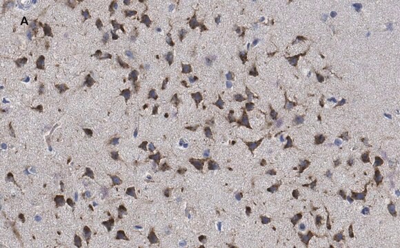 Anti-phospho-GluR1 (Ser831) Antibody, clone N453, ZooMAb&#174; Rabbit Monoclonal recombinant, expressed in HEK 293 cells