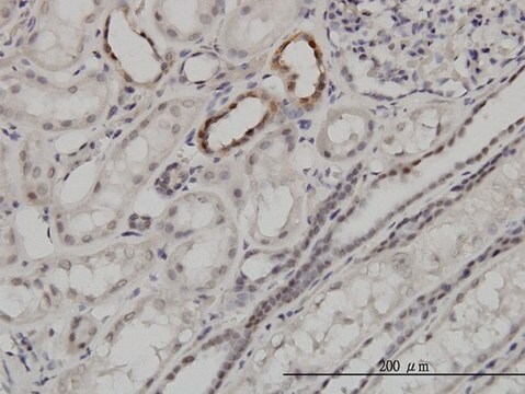 Monoclonal Anti-ARID1B antibody produced in mouse clone 2D2, purified immunoglobulin, buffered aqueous solution