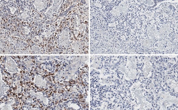 Anti-HSV-2 Nucleocapsid p40 Antibody, clone 3E1