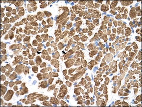 Anti-TPM2 antibody produced in rabbit IgG fraction of antiserum