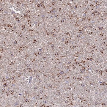 Anti-ARL8A antibody produced in rabbit Prestige Antibodies&#174; Powered by Atlas Antibodies, affinity isolated antibody, buffered aqueous glycerol solution