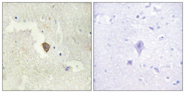 Anti-ADCY7 antibody produced in rabbit affinity isolated antibody